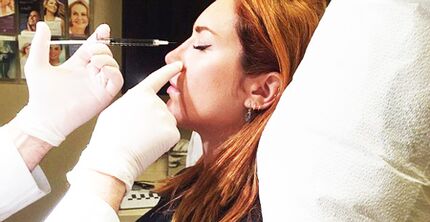 Procedimento de rinoplastia com preenchimento