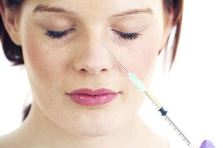 Rinoplastia não cirúrgica com preenchimentos