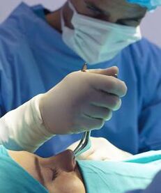 realizando cirurgia plástica fechada do nariz