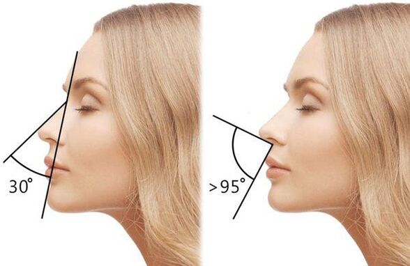 medição do ângulo do nariz